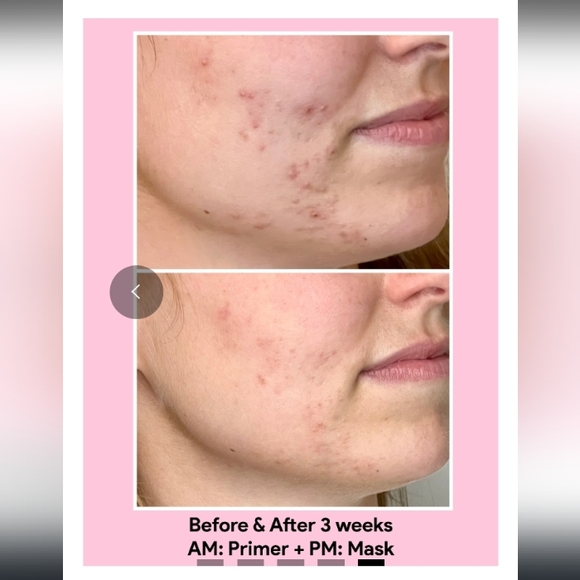 Jori Rx Acne Control Primer - Picture 4 of 5